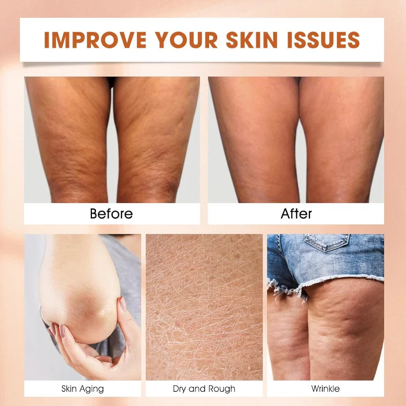 hadaclub ApisDerm Advanced Multi-Action Firming Cream,Bee Venom Wrinkle Removal Cream,Bee Venom Firming Serum Stick,for All Skin